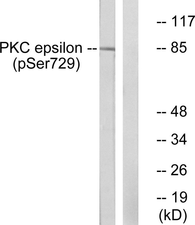 PRKCE / PKC-Epsilon Antibody - Western blot analysis of lysates from HeLa cells treated with PMA 125ng/ml 30', using PKC epsilon (Phospho-Ser729) Antibody. The lane on the right is blocked with the phospho peptide.