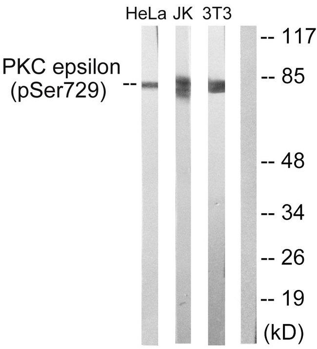 PRKCE / PKC-Epsilon Antibody - Western blot analysis of extracts from HeLa cells (line 1), Jurkat cells (line 2) and NIH/3T3 cells (line 3) all treated with PMA (125ng/ml, 30mins), using PKC e (Phospho-Ser729) antibody.