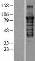 PRKCE / PKC-Epsilon Protein - Western validation with an anti-DDK antibody * L: Control HEK293 lysate R: Over-expression lysate