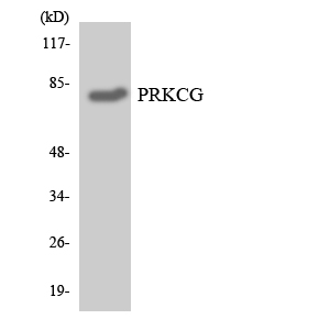 PRKCG / PKC-Gamma Antibody - Western blot analysis of the lysates from HT-29 cells using PRKCG antibody.