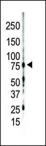 PRKCG / PKC-Gamma Antibody - Western blot of anti-PKC gamma C-term antibody in mouse brain lysate. PKC gamma (arrow) was detected using purified antibody. Secondary HRP-anti-rabbit was used for signal visualization with chemiluminescence.