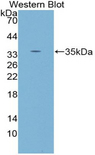 PRKCG / PKC-Gamma Antibody - Western blot of recombinant PRKCG / PKC-Gamma.