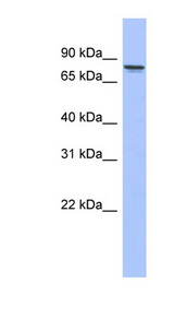 PRKCG / PKC-Gamma Antibody - PRKCG / PKC-Gamma antibody Western blot of Placenta lysate. This image was taken for the unconjugated form of this product. Other forms have not been tested.