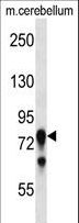 PRKCG / PKC-Gamma Antibody - Mouse Prkcg Antibody western blot of mouse cerebellum tissue lysates (35 ug/lane). The Prkcg antibody detected the Prkcg protein (arrow).