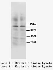 PRKCG / PKC-Gamma Antibody -  This image was taken for the unconjugated form of this product. Other forms have not been tested.