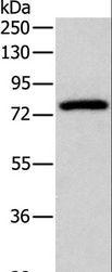 PRKCG / PKC-Gamma Antibody - Western blot analysis of Mouse brain tissue, using PRKCG Polyclonal Antibody at dilution of 1:500.