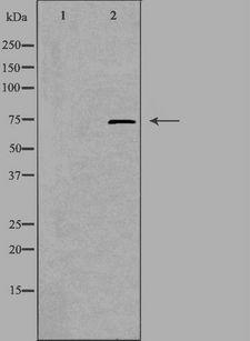 PRKCG / PKC-Gamma Antibody - Western blot analysis of extracts of A549 cells using PRKCG antibody. The lane on the left is treated with the antigen-specific peptide.