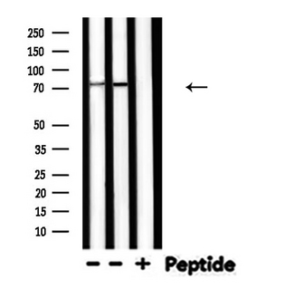PRKCG / PKC-Gamma Antibody - Western blot analysis of PRKCG expression in various lysates