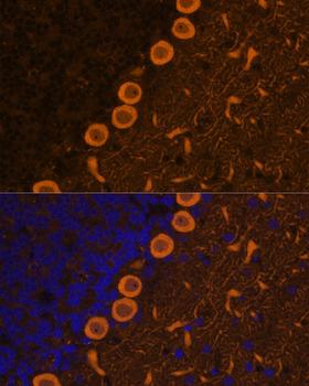 PRKCG / PKC-Gamma Antibody - Immunofluorescence analysis of Rat brain cells using PRKCG Polyclonal Antibody at dilution of 1:100.Blue: DAPI for nuclear staining.