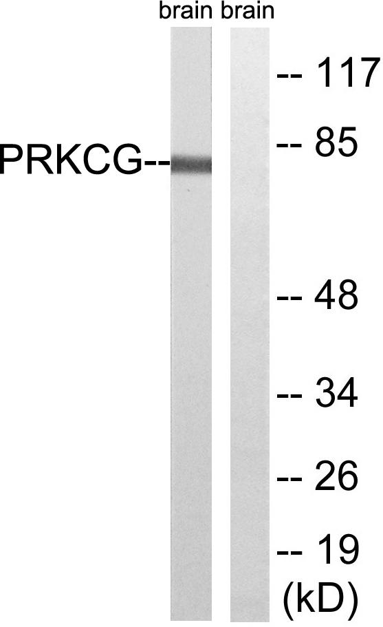 PRKCG / PKC-Gamma Antibody - Western blot analysis of extracts from Rat brain cells, using PRKCG(Ab-655) antibody.