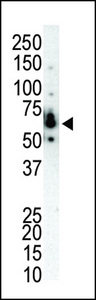 PRKCH / PKC-Eta Antibody - Western blot of anti-PKC eta N-term antibody in NCI-H460 cell lysate. PKC eta (arrow) was detected using purified antibody. Secondary HRP-anti-rabbit was used for signal visualization with chemiluminescence.