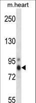 PRKCH / PKC-Eta Antibody - Mouse Prkch Antibody western blot of mouse heart tissue lysates (35 ug/lane). The Prkch antibody detected the Prkch protein (arrow).