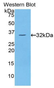 PRKCH / PKC-Eta Antibody - Western blot of recombinant PRKCH / PKC-Eta.  This image was taken for the unconjugated form of this product. Other forms have not been tested.