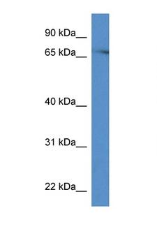 PRKCH / PKC-Eta Antibody - PRKCH / PKC-Eta antibody Western blot of Mouse Brain lysate. Antibody concentration 1 ug/ml. This image was taken for the unconjugated form of this product. Other forms have not been tested.