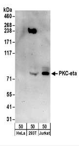 PRKCH / PKC-Eta Antibody - Detection of Human PKC-eta by Western Blot. Samples: Whole cell lysate (50 ug) from HeLa, 293T, and Jurkat cells. Antibodies: Affinity purified rabbit anti-PKC-eta antibody used for WB at 0.1 ug/ml. Detection: Chemiluminescence with an exposure time of 3 minutes.