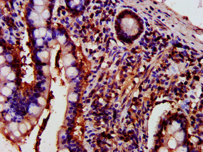 PRKCH / PKC-Eta Antibody - IHC image of PRKCH Antibody diluted at 1:700 and staining in paraffin-embedded human small intestine tissue performed on a Leica BondTM system. After dewaxing and hydration, antigen retrieval was mediated by high pressure in a citrate buffer (pH 6.0). Section was blocked with 10% normal goat serum 30min at RT. Then primary antibody (1% BSA) was incubated at 4°C overnight. The primary is detected by a biotinylated secondary antibody and visualized using an HRP conjugated SP system.