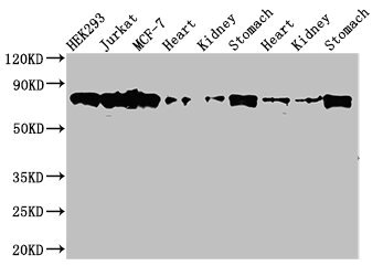 PRKCH / PKC-Eta Antibody - Western Blot Positive WB detected in: HEK293 whole cell lysate, Jurkat whole cell lysate, MCF-7 whole cell lysate, Rat heart tissue, Rat kideny tissue, Rat stomach tissue, Mouse heart tissue, Mouse kidney tissue, Mouse stomach tissue All lanes: PRKCH antibody at 3.5µg/ml Secondary Goat polyclonal to rabbit IgG at 1/50000 dilution Predicted band size: 78, 60 kDa Observed band size: 78 kDa