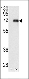 PRKCI / PKC Iota Antibody - Western blot of PRKCI (arrow) using rabbit polyclonal PKC iota Antibody. 293 cell lysates (2 ug/lane) either nontransfected (Lane 1) or transiently transfected with the PRKCI gene (Lane 2) (Origene Technologies).
