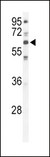PRKCI / PKC Iota Antibody - Western blot of hPKC-iota-C181 in HeLa cell line lysates (35 ug/lane). PKC (arrow) was detected using the purified antibody.