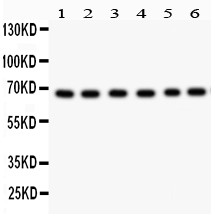 PRKCI / PKC Iota Antibody - PKC iota antibody Western blot. All lanes: Anti PKC iota at 0.5 ug/ml. Lane 1: SHG Whole Cell Lysate at 40 ug. Lane 2: A549 Whole Cell Lysate at 40 ug. Lane 3: U87 Whole Cell Lysate at 40 ug. Lane 4: 293T Whole Cell Lysate at 40 ug. Lane 5: HELA Whole Cell Lysate at 40 ug. Lane 6: JURKAT Whole Cell Lysate at 40 ug. Predicted band size: 68 kD. Observed band size: 68 kD.