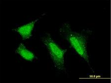 PRKCI / PKC Iota Antibody - Immunofluorescence of monoclonal antibody to PRKCI on HeLa cell . [antibody concentration 10 ug/ml]