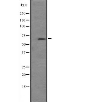 PRKCI / PKC Iota Antibody - Western blot analysis of PRKCI expression in Jurkat whole cells lysate. The lane on the left is treated with the antigen-specific peptide.
