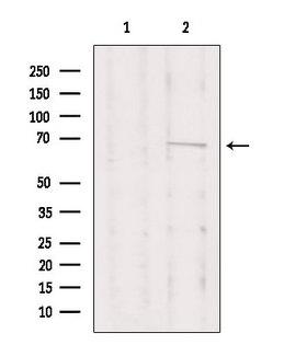 PRKCI / PKC Iota Antibody - Western blot analysis of extracts of HeLa cells using PRKCI antibody. Lane 1 was treated with the blocking peptide.