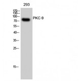 PRKCQ / PKC-Theta Antibody - Western blot of PKC theta antibody
