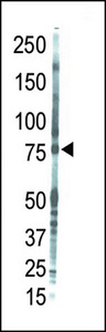 PRKCQ / PKC-Theta Antibody - Western blot of anti-PKC theta antibody in placenta lysate. PKC theta (Arrow) was detected using purified antibody. Secondary HRP-anti-rabbit was used for signal visualization with chemiluminescence.