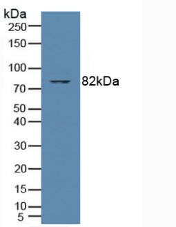 PRKCQ / PKC-Theta Antibody - Western Blot; Sample: Human Jurkat Cells.