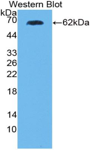 PRKCQ / PKC-Theta Antibody - Western blot of PRKCQ / PKC-Theta antibody.