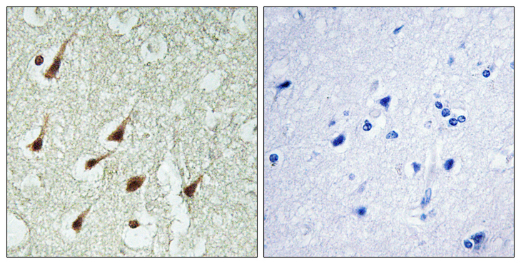 PRKCQ / PKC-Theta Antibody - Immunohistochemistry analysis of paraffin-embedded human brain, using PKC thet Antibody. The picture on the right is blocked with the synthesized peptide.