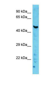 PRKCQ / PKC-Theta Antibody - Western blot of Mouse Lung. Prkcq antibody dilution 1.0 ug/ml.  This image was taken for the unconjugated form of this product. Other forms have not been tested.