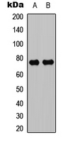 PRKCQ / PKC-Theta Antibody - Western blot analysis of PKC theta expression in MCF7 (A); Jurkat (B) whole cell lysates.