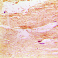 PRKCQ / PKC-Theta Antibody - Immunohistochemical analysis of PKC theta staining in human skeletal muscle formalin fixed paraffin embedded tissue section. The section was pre-treated using heat mediated antigen retrieval with sodium citrate buffer (pH 6.0). The section was then incubated with the antibody at room temperature and detected using an HRP conjugated compact polymer system. DAB was used as the chromogen. The section was then counterstained with hematoxylin and mounted with DPX.