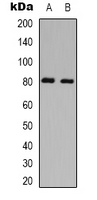 PRKCQ / PKC-Theta Antibody - Western blot analysis of PKC theta (pS695) expression in Jurkat PMA-treated (A); HEK293T PMA-treated (B) whole cell lysates.