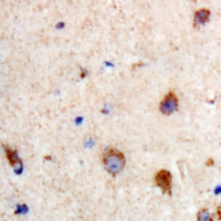 PRKCQ / PKC-Theta Antibody - Immunohistochemical analysis of PKC theta (pS695) staining in human brain formalin fixed paraffin embedded tissue section. The section was pre-treated using heat mediated antigen retrieval with sodium citrate buffer (pH 6.0). The section was then incubated with the antibody at room temperature and detected using an HRP polymer system. DAB was used as the chromogen. The section was then counterstained with hematoxylin and mounted with DPX.