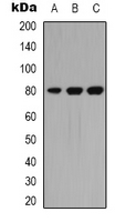 PRKCQ / PKC-Theta Antibody - Western blot analysis of PKC theta expression in A549 (A); HeLa (B); Jurkat (C) whole cell lysates.
