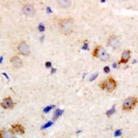 PRKCQ / PKC-Theta Antibody - Immunohistochemical analysis of PKC theta staining in human brain formalin fixed paraffin embedded tissue section. The section was pre-treated using heat mediated antigen retrieval with sodium citrate buffer (pH 6.0). The section was then incubated with the antibody at room temperature and detected using an HRP polymer system. DAB was used as the chromogen. The section was then counterstained with hematoxylin and mounted with DPX.