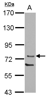 PRKCQ / PKC-Theta Antibody - Sample (30 ug of whole cell lysate) A: Jurkat 7.5% SDS PAGE PRKCQ / PKC-Theta antibody diluted at 1:1000