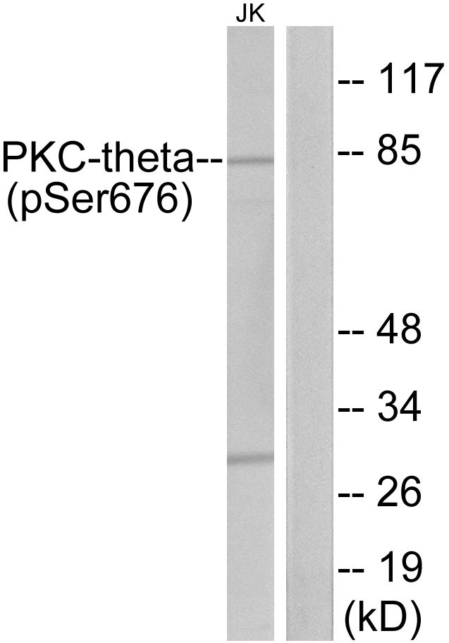 PRKCQ / PKC-Theta Antibody - Western blot analysis of lysates from Jurkat cells treated with PMA 200nM 30', using PKC thet (Phospho-Ser676) Antibody. The lane on the right is blocked with the phospho peptide.