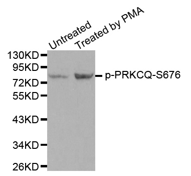 PRKCQ / PKC-Theta Antibody - Western blot analysis of extracts from PC12 cells.