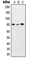 PRKCQ / PKC-Theta Antibody - Western blot analysis of PKC theta (pS676) expression in HeLa UV-treated (A); SP2/0 UV-treated (B); PC12 UV-treated (C) whole cell lysates.