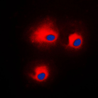PRKCQ / PKC-Theta Antibody - Immunofluorescent analysis of PKC theta (pS676) staining in HeLa cells. Formalin-fixed cells were permeabilized with 0.1% Triton X-100 in TBS for 5-10 minutes and blocked with 3% BSA-PBS for 30 minutes at room temperature. Cells were probed with the primary antibody in 3% BSA-PBS and incubated overnight at 4 C in a humidified chamber. Cells were washed with PBST and incubated with a DyLight 594-conjugated secondary antibody (red) in PBS at room temperature in the dark. DAPI was used to stain the cell nuclei (blue).