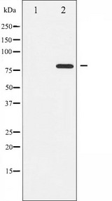 PRKCQ / PKC-Theta Antibody - Western blot analysis of PKC theta phosphorylation expression in PMA treated Jurkat whole cells lysates. The lane on the left is treated with the antigen-specific peptide.