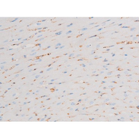 PRKCQ / PKC-Theta Antibody - 1:200 staining mouse heart tissue by IHC-P. The tissue was formaldehyde fixed and a heat mediated antigen retrieval step in citrate buffer was performed. The tissue was then blocked and incubated with the antibody for 1.5 hours at 22°C. An HRP conjugated goat anti-rabbit antibody was used as the secondary.