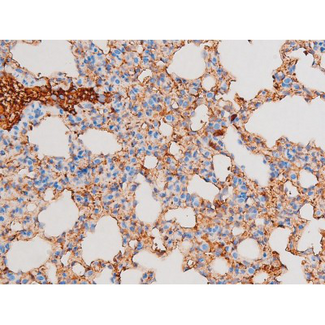 PRKCQ / PKC-Theta Antibody - 1:200 staining mouse lung tissue by IHC-P. The tissue was formaldehyde fixed and a heat mediated antigen retrieval step in citrate buffer was performed. The tissue was then blocked and incubated with the antibody for 1.5 hours at 22°C. An HRP conjugated goat anti-rabbit antibody was used as the secondary.