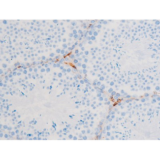 PRKCQ / PKC-Theta Antibody - 1:200 staining mouse testis tissue by IHC-P. The tissue was formaldehyde fixed and a heat mediated antigen retrieval step in citrate buffer was performed. The tissue was then blocked and incubated with the antibody for 1.5 hours at 22°C. An HRP conjugated goat anti-rabbit antibody was used as the secondary.