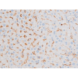 PRKCQ / PKC-Theta Antibody - 1:200 staining rat liver tissue by IHC-P. The tissue was formaldehyde fixed and a heat mediated antigen retrieval step in citrate buffer was performed. The tissue was then blocked and incubated with the antibody for 1.5 hours at 22°C. An HRP conjugated goat anti-rabbit antibody was used as the secondary.