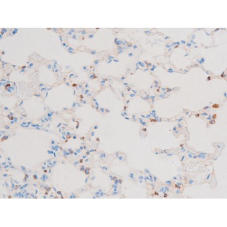 PRKCQ / PKC-Theta Antibody - 1:200 staining rat lung tissue by IHC-P. The tissue was formaldehyde fixed and a heat mediated antigen retrieval step in citrate buffer was performed. The tissue was then blocked and incubated with the antibody for 1.5 hours at 22°C. An HRP conjugated goat anti-rabbit antibody was used as the secondary.